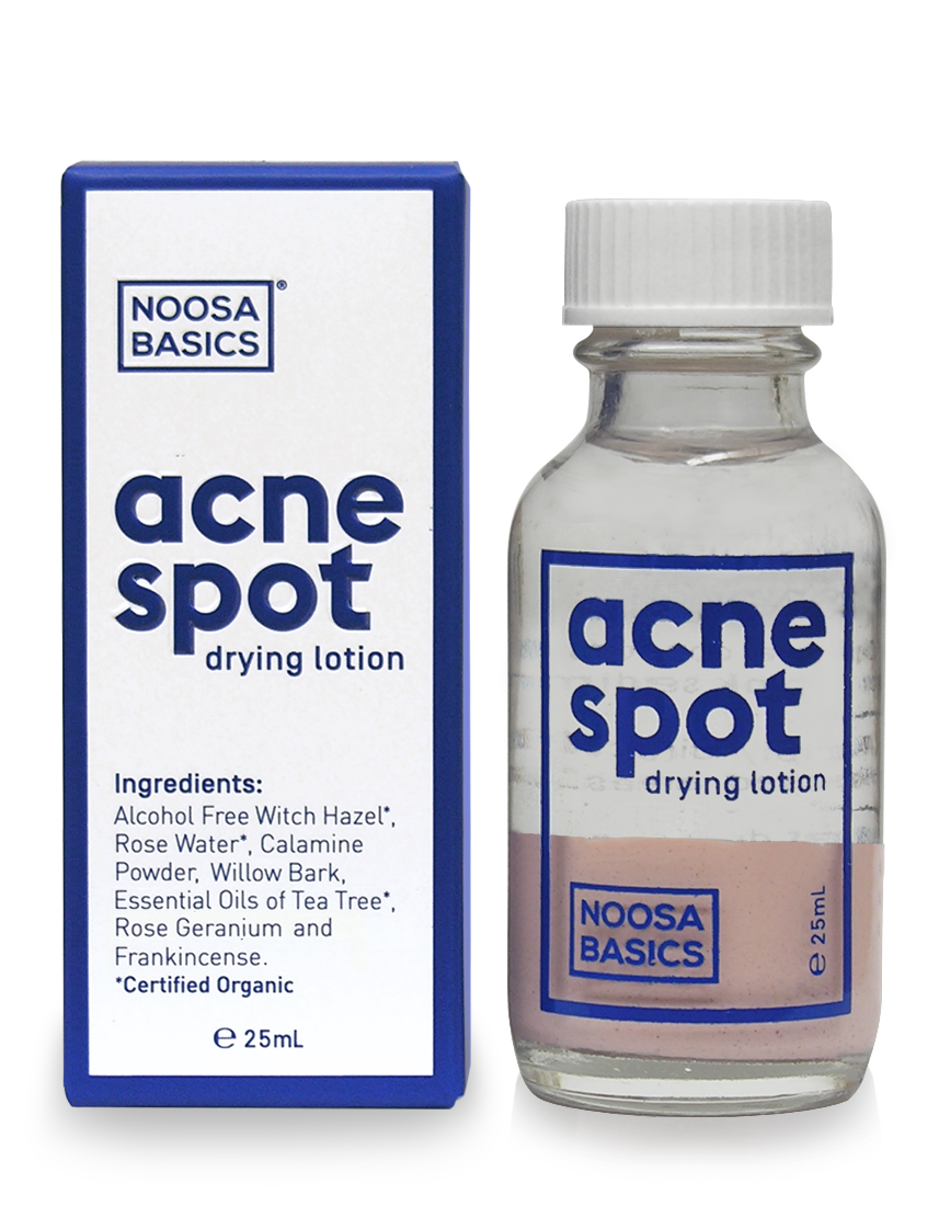 Noosa Basics Acne Lotion